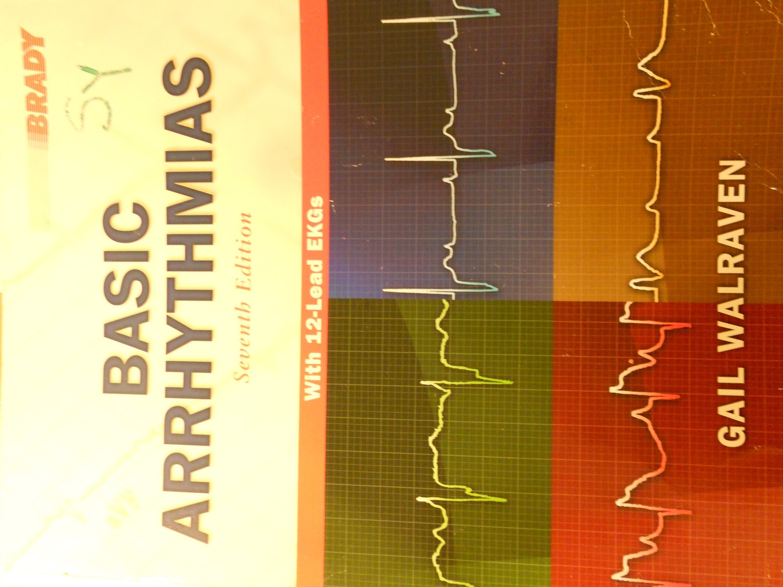 Basic Arrhythmias, 7th Edition – paperback Walraven, Gail