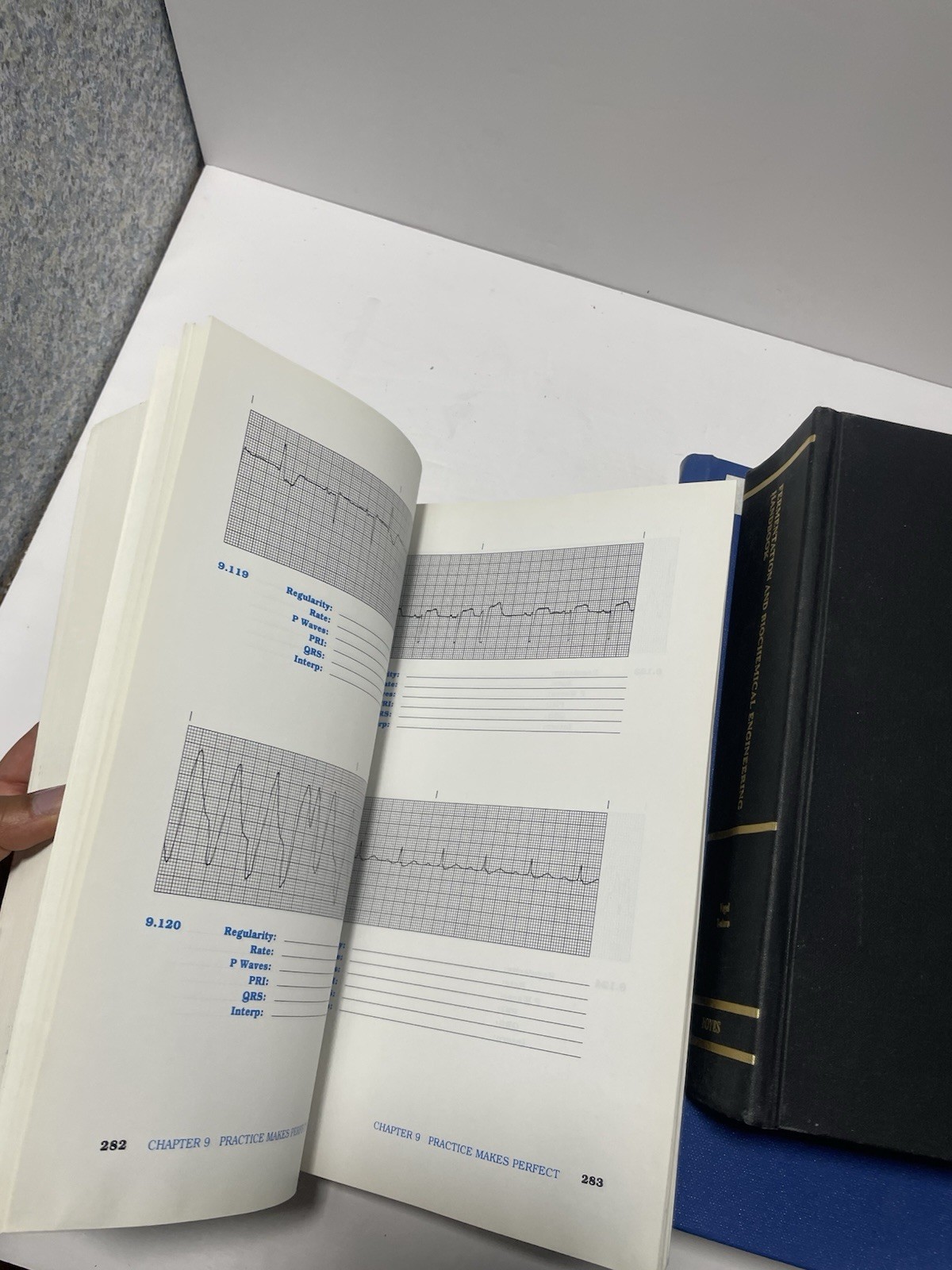 Basic Arrhythmias Paperback Iris G. Walraven