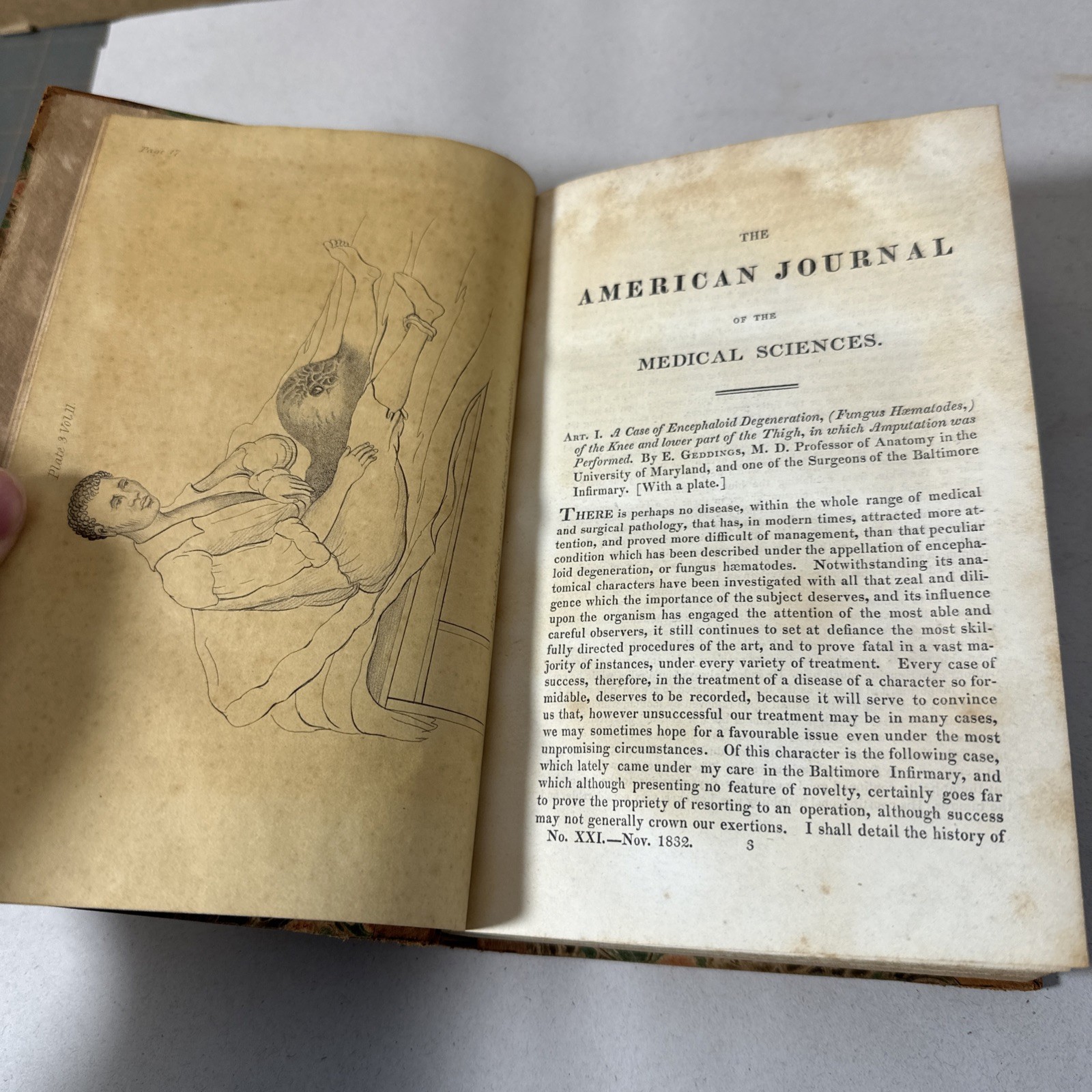 American Journal Medical Sciences 1832 First Edition Book Plates Volume 11