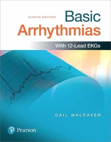 Basic Arrhythmias Plus – Printed Access Code, by Walraven Gail – Very Good